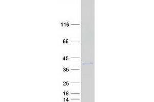 Validation with Western Blot