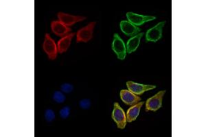 ABIN6257165 and ABIN6275114 staining HepG2 cells by IF/ICC. (EPN3 anticorps  (Internal Region))