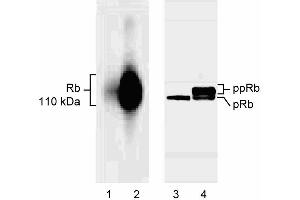 Selective binding of G99-549 to underphosphorylated Rb. (Retinoblastoma 1 anticorps  (underphosphorylated))
