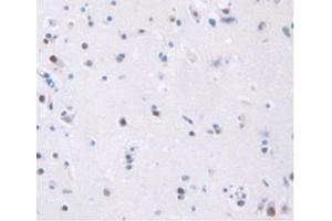 Detection of TFR in Human Brain Tissue using Anti-Transferrin Receptor (TFR) Polyclonal Antibody (Transferrin Receptor anticorps  (AA 567-744))