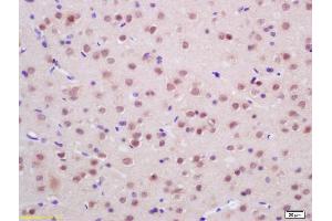 Formalin-fixed and paraffin embedded rat brain Rabbit Anti Endo G Polyclonal Antibody, Unconjugated (ABIN680893) at 1:200 followed by conjugation to the secondary antibody and DAB staining