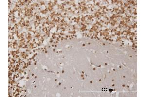 Immunoperoxidase of monoclonal antibody to EN1 on formalin-fixed paraffin-embedded human cerebellum. (EN1 anticorps  (AA 266-392))