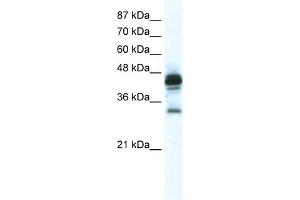 WB Suggested Anti-GJE1 Antibody Titration:  2. (GJE1 anticorps  (C-Term))