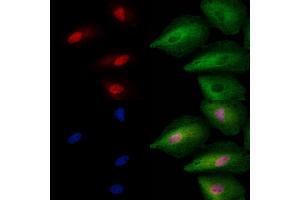 ABIN6257713 and ABIN6273763 staining  cells by IF/ICC. (ING2 anticorps  (C-Term))