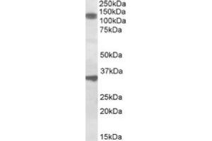 Image no. 1 for anti-DIX Domain Containing 1 (DIXDC1) (Internal Region) antibody (ABIN487984) (DIXDC1 anticorps  (Internal Region))
