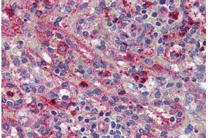 Anti-ACVR1C antibody  ABIN1048286 IHC staining of human spleen.