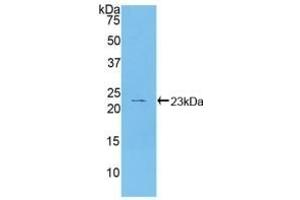 Detection of Recombinant HSPb2, Human using Polyclonal Antibody to Heat Shock Protein Beta 2 (HSPb2)
