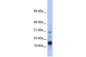 WB Suggested Anti-HIST2H2BF Antibody Titration: 0. (HIST2H2BF anticorps  (N-Term))