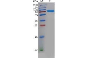 Human CHODL Protein, hFc Tag on SDS-PAGE under reducing condition.
