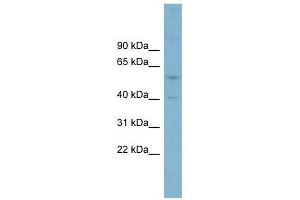 SUSD4 antibody used at 1 ug/ml to detect target protein. (SUSD4 anticorps  (Middle Region))