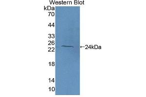 Figure. (TBXAS1 anticorps  (AA 357-533))
