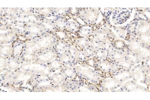 Detection of GSN in Bovine Kidney Tissue using Monoclonal Antibody to Gelsolin (GSN)