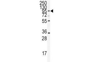 Western blot analysis of ADAMTS13 antibody and CEM lysate.