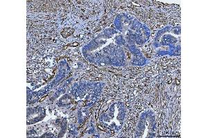 IHC analysis of TP53I13 using anti-TP53I13 antibody (ABIN7601220). (TP53I13 anticorps  (AA 30-365))