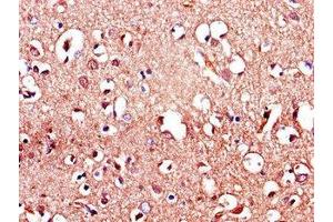 Immunohistochemistry of paraffin-embedded human brain tissue using ABIN7158114 at dilution of 1:100 (LRRTM4 anticorps  (AA 259-419))