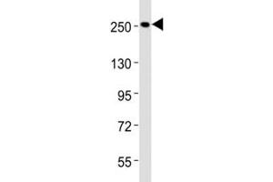 Western blot testing of Nestin antibody at 1:2000 dilution + HeLa lysate