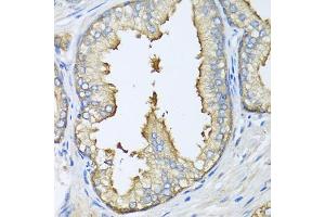 Immunohistochemistry of paraffin-embedded human prostate using ATG5 antibody. (ATG5 anticorps)