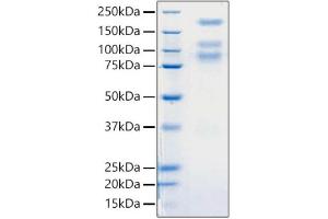 Recombinant 2019-nCoV S1+S2 ECD (S-ECD) Protein was determined by SDS-PAGE with Coomassie Blue, showing bands around 80, 110, 180 kDa.