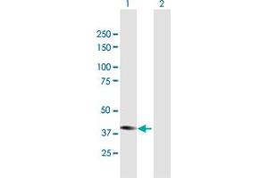 Western Blot analysis of STYK1 expression in transfected 293T cell line by STYK1 MaxPab polyclonal antibody. (STYK1 anticorps  (AA 1-422))