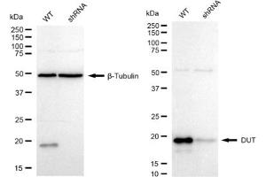 Western blotting analysis using DUT antibody (ABIN7798312).