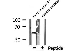 Western blot analysis of extracts from mouse muscle, using KCNQ1 Antibody.