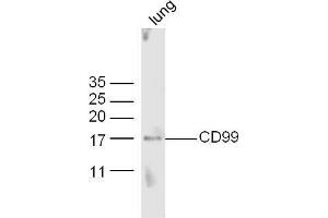Mouse lung lysates probed with Anti-CD99 Polyclonal Antibody, Unconjugated  at 1:5000 90min in 37˚C. (CD99 anticorps  (AA 45-150))