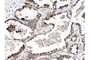 IHC analysis of RanBP1 using anti- RanBP1 antibody .