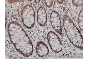 Immunoperoxidase of monoclonal antibody to USP48 on formalin-fixed paraffin-embedded human colon.