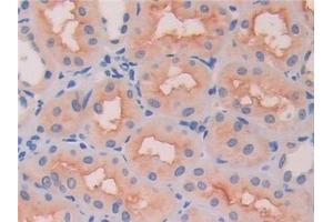 Detection of HEXb in Human Kidney Tissue using Polyclonal Antibody to Hexosaminidase B Beta (HEXb) (HEXB anticorps  (AA 122-311))