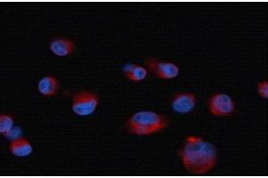 ICC/IF Image Immunofluorescence analysis of paraformaldehyde-fixed human pancreatic cancer cell line, using CXCR7, antibody at 1:50 dilution.