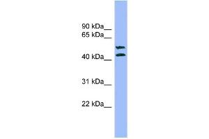 WB Suggested Anti-TMPRSS3 Antibody Titration: 0. (TMPRSS3 anticorps  (N-Term))