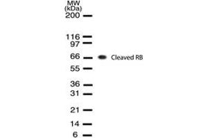 Image no. 1 for anti-Retinoblastoma Protein (Rb Protein) (Cleavage Site) antibody (ABIN207915) (Retinoblastoma Protein (Rb) anticorps  (Cleavage Site))
