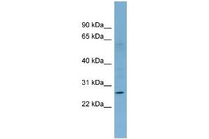 WB Suggested Anti-KLRF1 Antibody Titration:  0.