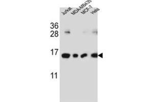 Western Blotting (WB) image for anti-H2A Histone Family, Member J (H2AFJ) antibody (ABIN3002385) (H2AFJ anticorps)