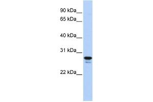 WB Suggested Anti-HMGB2 Antibody Titration: 0. (HMGB2 anticorps  (Middle Region))