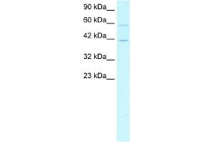 WB Suggested Anti-CREB5 Antibody Titration:  1. (CREB5 anticorps  (N-Term))