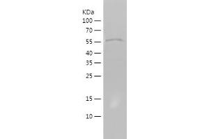 Western Blotting (WB) image for Activating Transcription Factor 6 (ATF6) (AA 1-182) protein (His-IF2DI Tag) (ABIN7121670) (ATF6 Protein (AA 1-182) (His-IF2DI Tag))