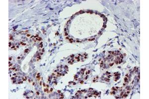 Immunohistochemical staining of paraffin-embedded Human breast tissue using anti-WWTR1 mouse monoclonal antibody. (WWTR1 anticorps)