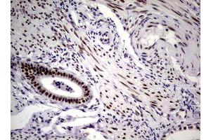 Image no. 7 for anti-Nibrin (NBN) (AA 183-460) antibody (ABIN1491066)