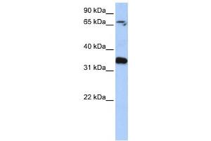 Western Blotting (WB) image for anti-GLE1 RNA Export Mediator (GLE1) antibody (ABIN2459776)