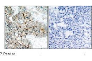 Image no. 1 for anti-Integrin beta 3 (ITGB3) (pTyr773) antibody (ABIN196720) (Integrin beta 3 anticorps  (pTyr773))