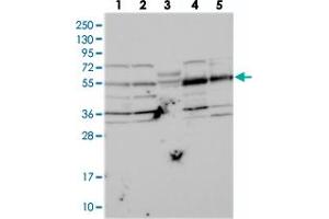 Western blot analysis of Lane 1: RT-4, Lane 2: U-251 MG, Lane 3: Human Plasma, Lane 4: Liver, Lane 5: Tonsil with NARFL polyclonal antibody  at 1:250-1:500 dilution. (NARFL anticorps)