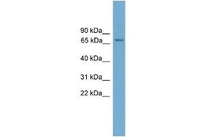 WB Suggested Anti-PRKCH AntibodyTitration: 1. (PKC eta anticorps  (N-Term))