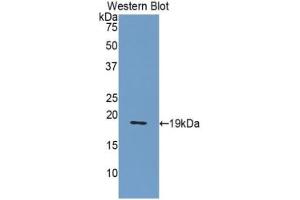 Detection of recombinant NUCB2 using Polyclonal Antibody to Nucleobindin 2 (NUCB2) (NUCB2 anticorps  (AA 108-246))