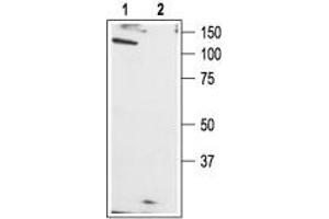Western blot analysis of rat brain membranes: - 1.