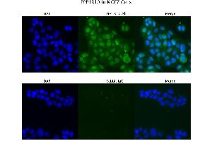 Sample Type :  MCF7   Primary Antibody Dilution:  4 ug/ml   Secondary Antibody :  Anti-rabbit Alexa 546   Secondary Antibody Dilution:  2 ug/ml   Gene Name :  PPP1R10 (PPP1R10 anticorps  (N-Term))