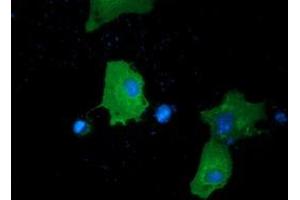 Immunofluorescence (IF) image for anti-Protein Kinase D2 (PKD2) antibody (ABIN1500413)