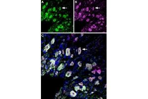 Immunolocalization of p75NTR and TrkA in rat dorsal root ganglion - Immunohistochemical staining of perfusion-fixed frozen rat dorsal root ganglia (DRG) sections using Anti-p75 NGF Receptor (extracellular)-ATTO Fluor-488 Antibody (ABIN7043345), (1:60) and Anti-TrkA (extracellular)-ATTO Fluor-633 Antibody (ABIN7043386), (1:60).