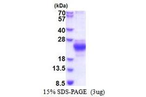 SDS-PAGE (SDS) image for ChaC, Cation Transport Regulator Homolog 2 (CHAC2) (AA 1-184) protein (His tag) (ABIN5853484)