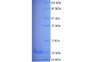 Major Urinary Protein 19 (MUP19) (AA 1-151), (full length) Protéine
